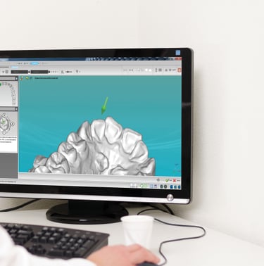 CBCT guided implant treatment planning