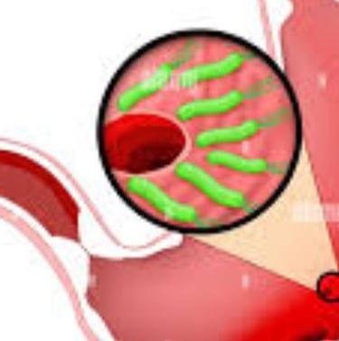 عسل مانوكا لبكتيريا الهيليكوباكتر بيلوري (H. pylori) والصيام