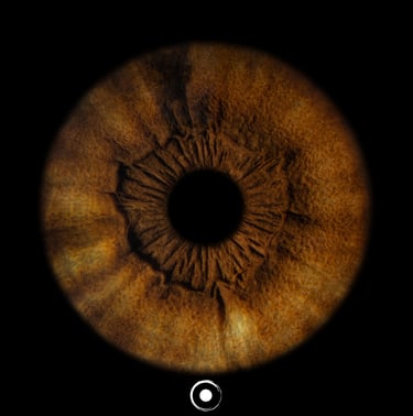 TheOculis®, Iris JPG®