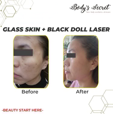 Body's Secret black doll laser
