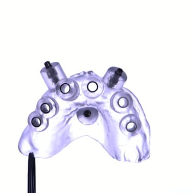 Guía quirúrgica impresa en 3D utilizada para cirugía de implantes dentales guiada