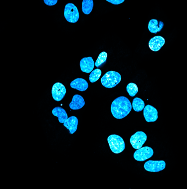 Fluorescence microscopy image showing glowing blue DAPI-stained cell nuclei, normal and toroidal.