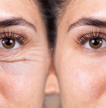 Oculoplastic Surgery