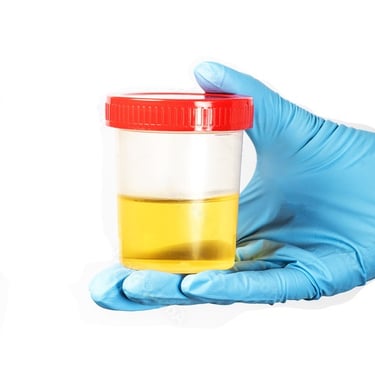 Urinary Tract Infection, Burning, Pee, Urine, Frequency, Antibiotics, Tests, Testing, UTI