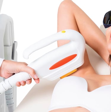 Depilación láser indolora, sistema SHR