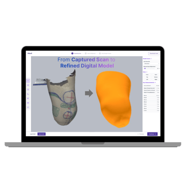 BenX prosthetic CAD modeling software