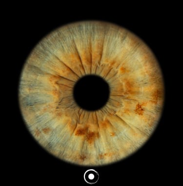 TheOculis®, Iris JPG®