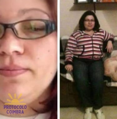 Photos of the administrator with side effects from corticosteroids.