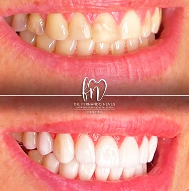 a before and after image of dental treatment