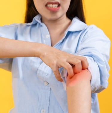 Rash, Itchy, Allergic Reaction, Cream, Medication, Skin, Itching, Hives, Bite