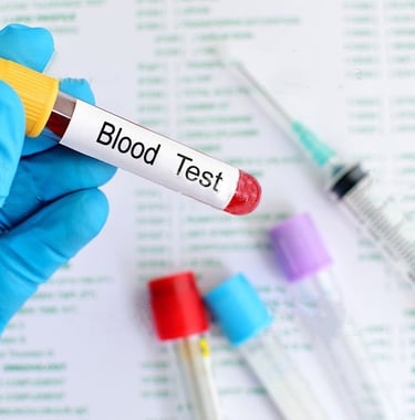 Labs, Blood work, Laboratory testing, Exams, Orders, Thyroid, Hormones