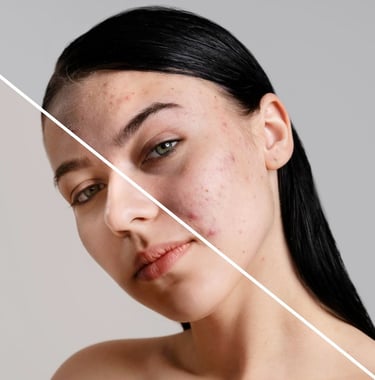 before after portrait woman retouched 1