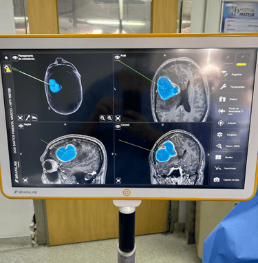 Francisco Torrao neuro cirurgião especialista em Nervos Perifericos e Plexo Braqueal no RJ 