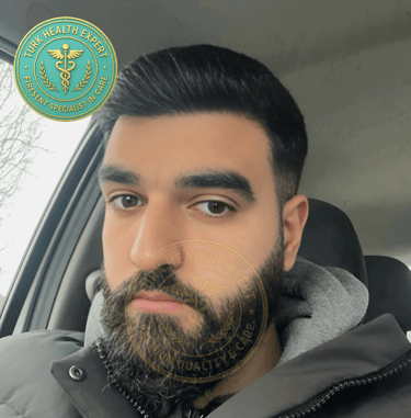 meme persone 9 mois apres sa greffe de cheveux sans rasage DHI