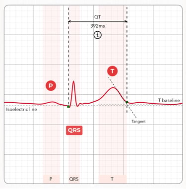 ECG heartbeat signature showing P, QRS, and T waves with Tangent line marked for QT measurement