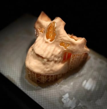 3D printed maxillofacial model