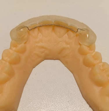 Fixed Bonded Retainer with 3D printed fitting jig