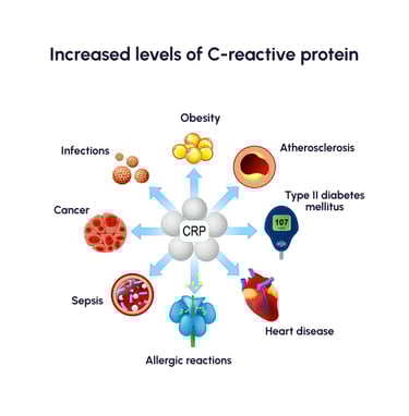 High-sensitivity C-reactive protein (hs-CRP)