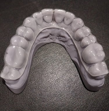 Dual Laminated Mouthguards