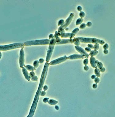 Microscopic view of Cladosporium showing fungal hyphae and budding yeast cells.