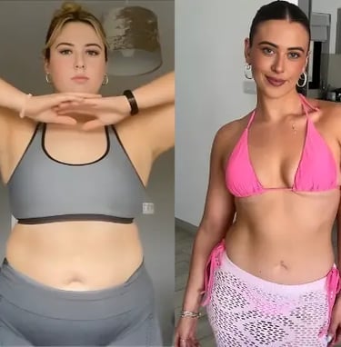 Novislim Vorher und Nachher