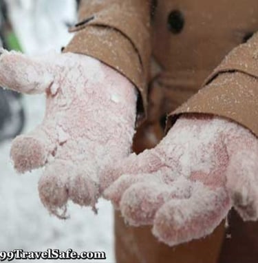 The Prevention and Treatment of Frostbite