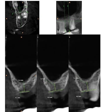 CBCT Scan Report