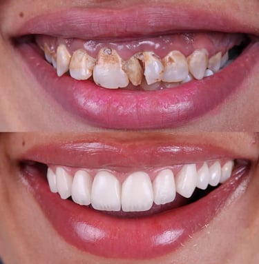 "dental treatments at low cost" "front teeth repair"dental clinic near me low cost low price dentist