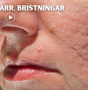 a person with scars in the face