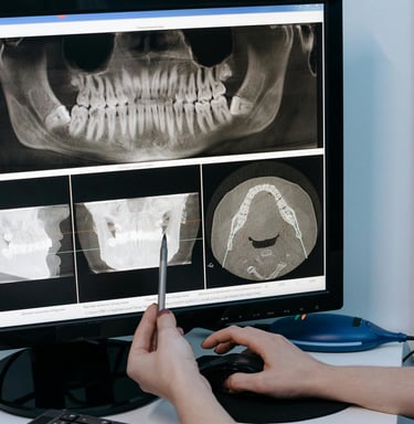 análisis de imágenes radiográficas dentales en tres dimensiones