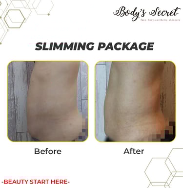 Body's Secret testimonial slimming
