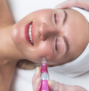 Microneedling Stafford