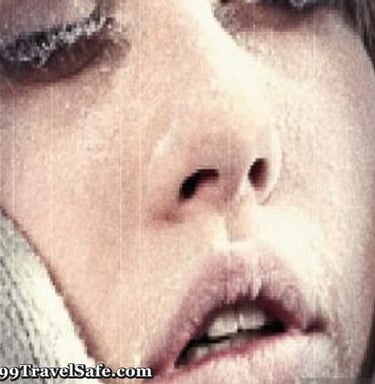 The Prevention and Treatment of Hypothermia
