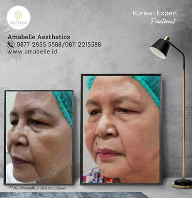 amabelle before after korean expert treatment