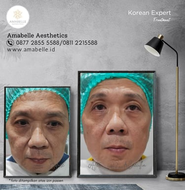 amabelle before after korean expert treatment