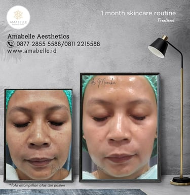 amabelle before after skincare routine