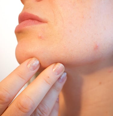 Before and after results of anti-aging treatment at Kandyan Aesthetics