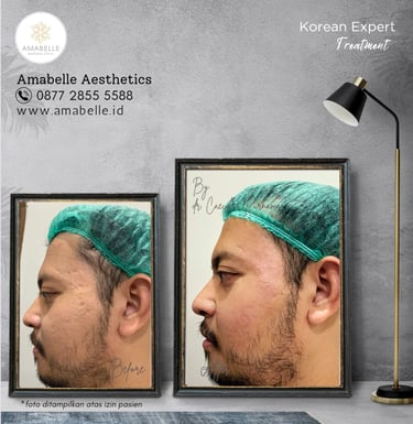 amabelle before after korean expert treatment
