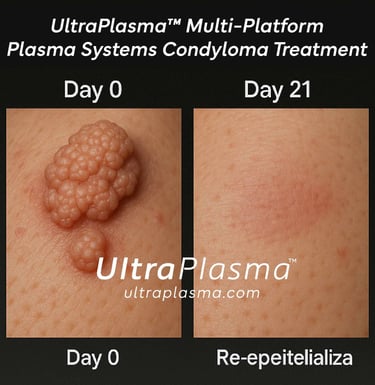 _ultra_plasma_ultra_plazma_ultra-plasma_ultra-plazma