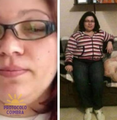 Fotos de la administradora con efectos secundarios de los corticoides.