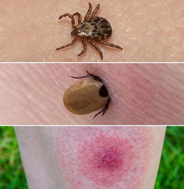 tiques, encéphalite estivale, Lyme, Dr Cédric Yves Bandelier, médecin généraliste , La Tour-de-Peilz