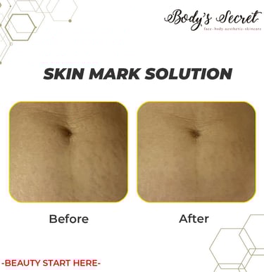 Body's Secret skin mark solution