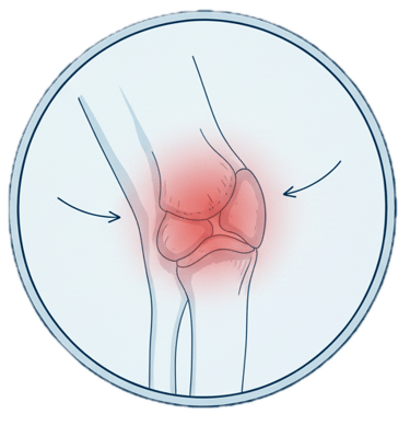 Lesões no Cotovelo - Patologias do Cotovelo