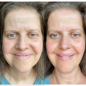 Lifeavntage Collagen Before and After - Woman Face (2)