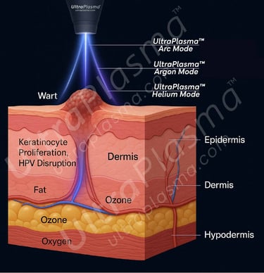 ultra_plasma_ultra_plazma_ultra-plasma_ultra-plazma