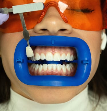 Professional teeth whitening treatment using a Zoom  in-office whitening system