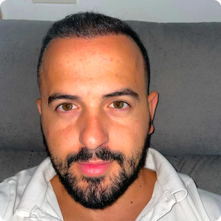 Cosmedic Express clinics in Turkey/Albania perform the worlds best hair transplants