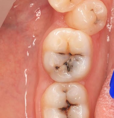 "best dentist near me, best dental clinic near me, best prosthodontist near me