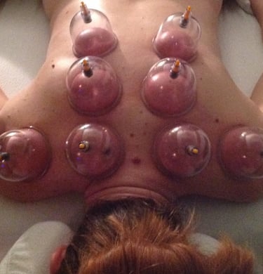 massage cupping