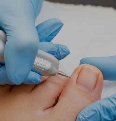 Professionelle Fußpflege, Fusspflege Overath..Fußüberholung mit Motor und Schleifmaschine